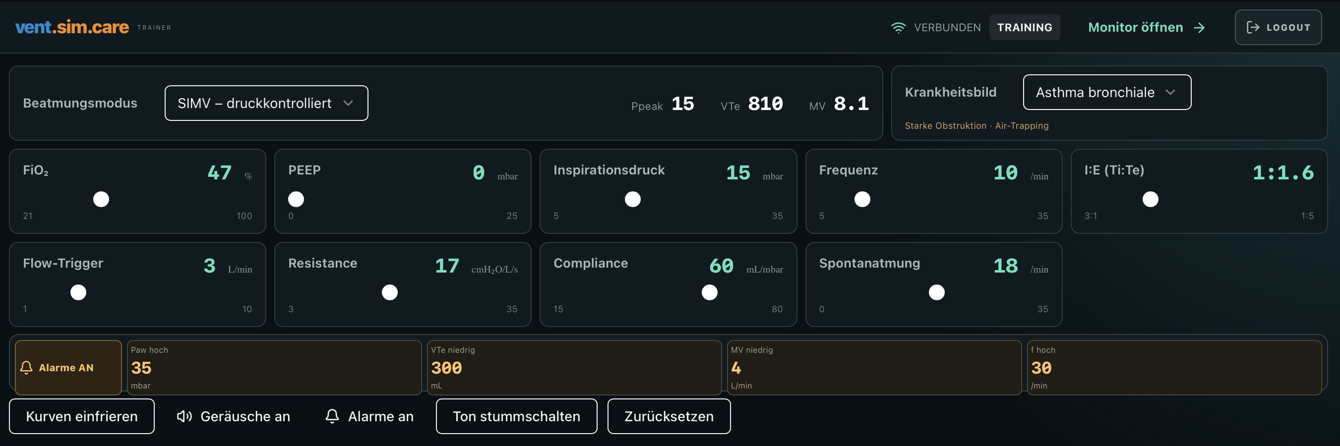 vent.sim.care – weitere Softwareansicht